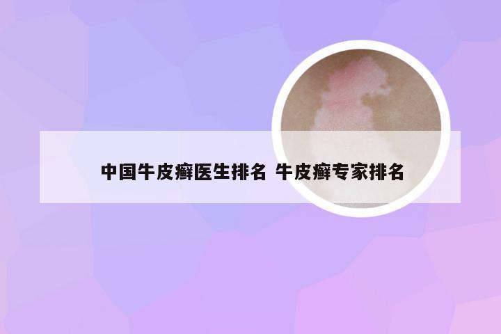 中国牛皮癣医生排名 牛皮癣专家排名