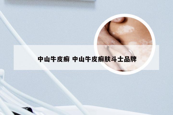 中山牛皮癣 中山牛皮癣肤斗士品牌