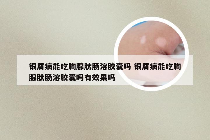 银屑病能吃胸腺肽肠溶胶囊吗 银屑病能吃胸腺肽肠溶胶囊吗有效果吗