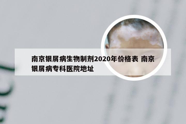 南京银屑病生物制剂2020年价格表 南京银屑病专科医院地址