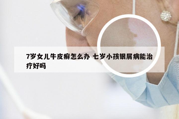 7岁女儿牛皮癣怎么办 七岁小孩银屑病能治疗好吗
