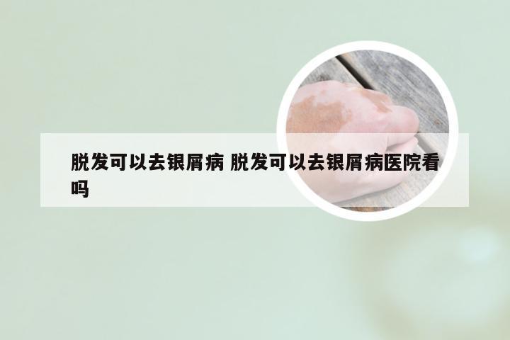 脱发可以去银屑病 脱发可以去银屑病医院看吗