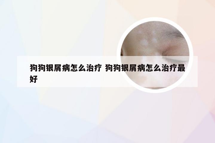 狗狗银屑病怎么治疗 狗狗银屑病怎么治疗最好