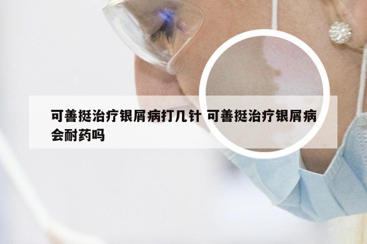可善挺治疗银屑病打几针 可善挺治疗银屑病会耐药吗