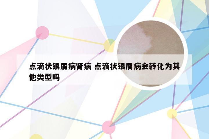 点滴状银屑病肾病 点滴状银屑病会转化为其他类型吗