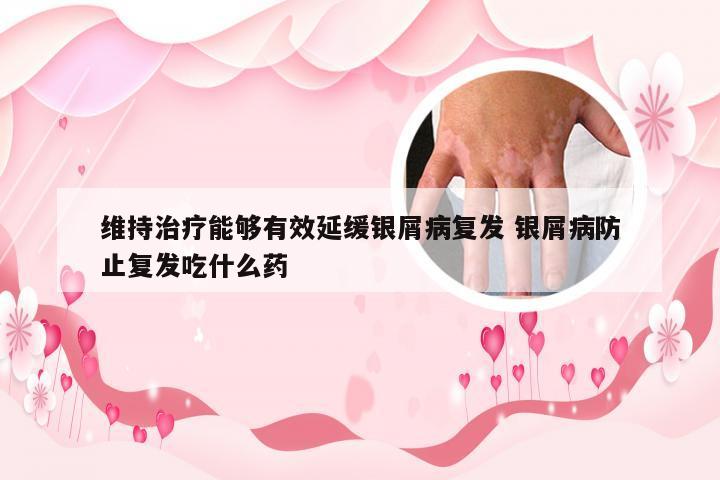 维持治疗能够有效延缓银屑病复发 银屑病防止复发吃什么药