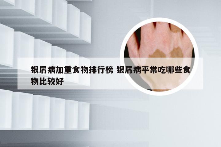 银屑病加重食物排行榜 银屑病平常吃哪些食物比较好