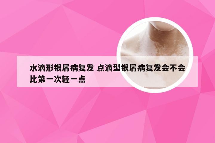 水滴形银屑病复发 点滴型银屑病复发会不会比第一次轻一点