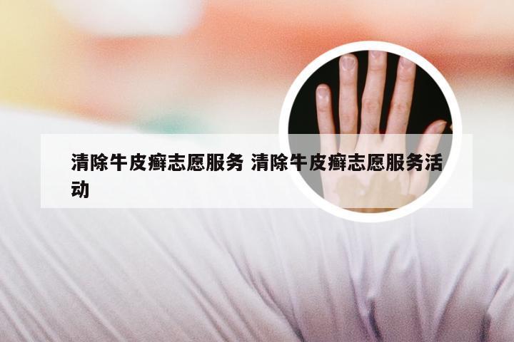 清除牛皮癣志愿服务 清除牛皮癣志愿服务活动