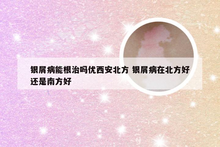 银屑病能根治吗优西安北方 银屑病在北方好还是南方好