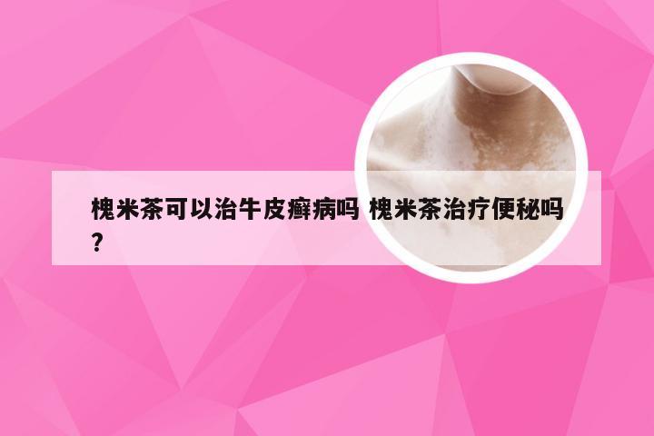 槐米茶可以治牛皮癣病吗 槐米茶治疗便秘吗?