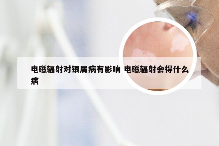 电磁辐射对银屑病有影响 电磁辐射会得什么病