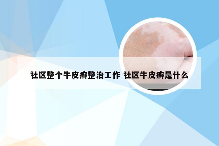 社区整个牛皮癣整治工作 社区牛皮癣是什么