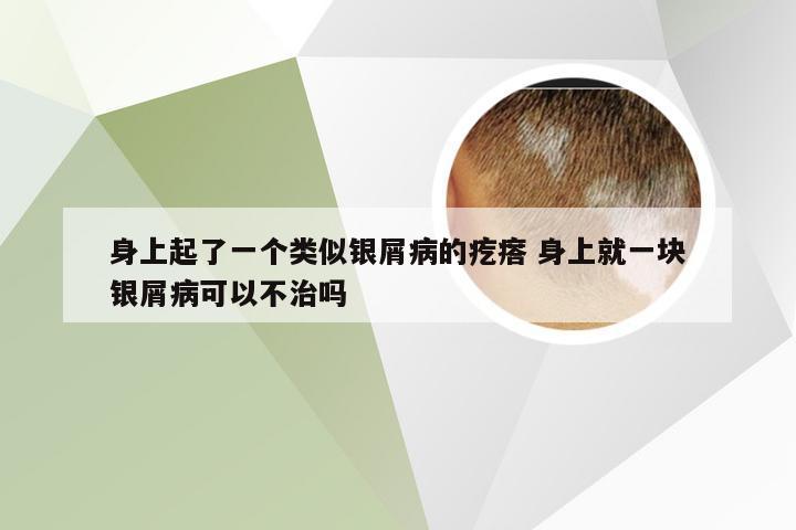 身上起了一个类似银屑病的疙瘩 身上就一块银屑病可以不治吗