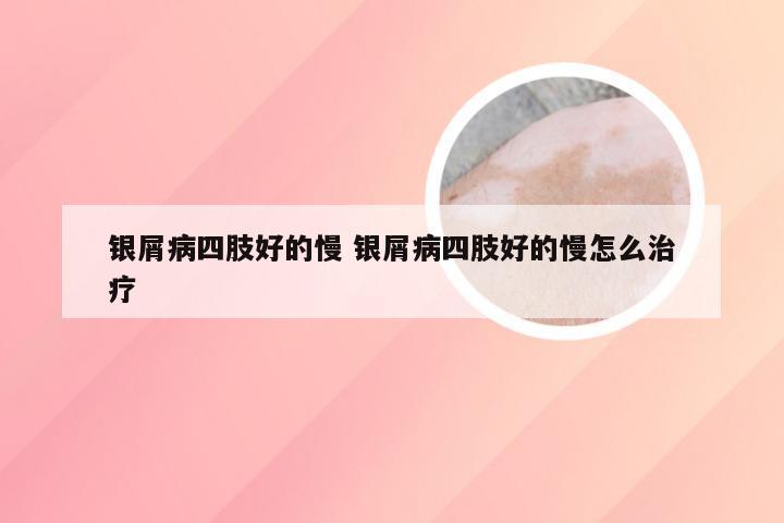 银屑病四肢好的慢 银屑病四肢好的慢怎么治疗