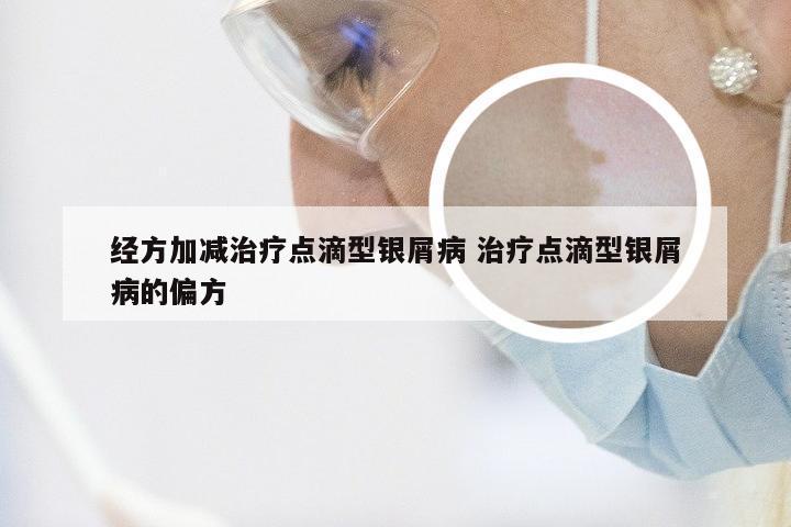 经方加减治疗点滴型银屑病 治疗点滴型银屑病的偏方