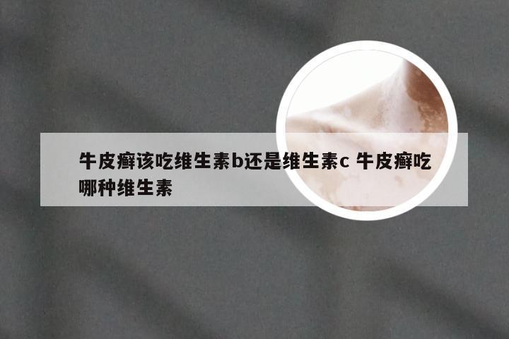 牛皮癣该吃维生素b还是维生素c 牛皮癣吃哪种维生素