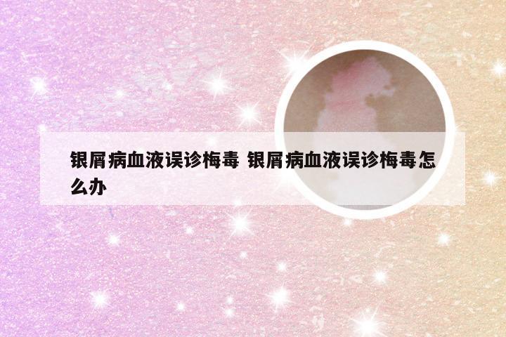 银屑病血液误诊梅毒 银屑病血液误诊梅毒怎么办
