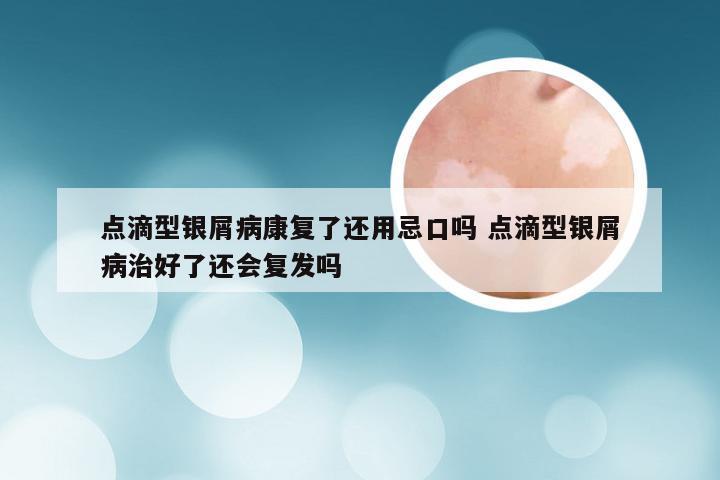 点滴型银屑病康复了还用忌口吗 点滴型银屑病治好了还会复发吗