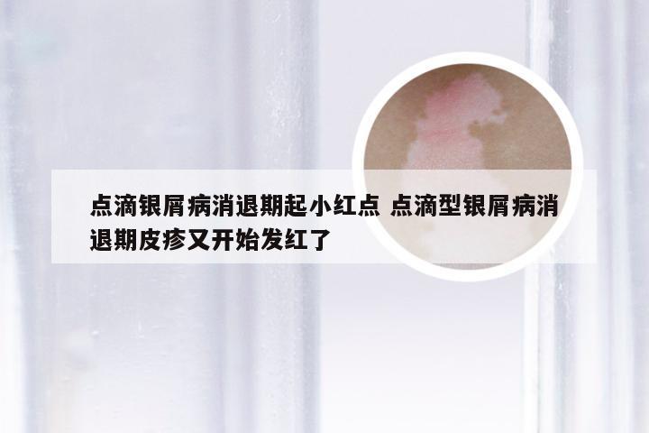 点滴银屑病消退期起小红点 点滴型银屑病消退期皮疹又开始发红了