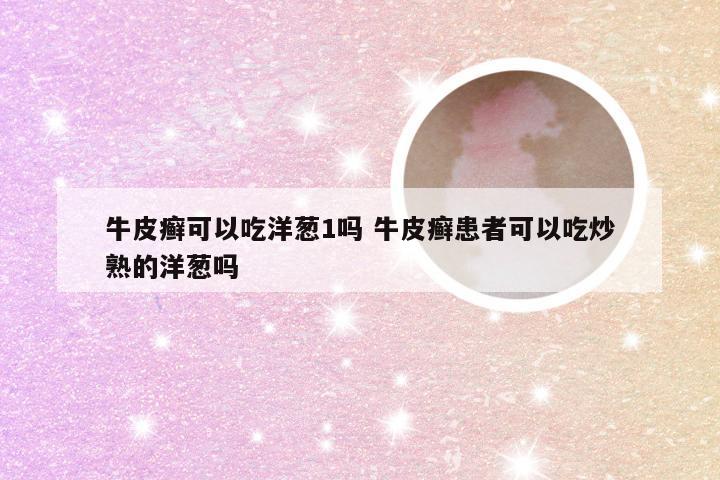 牛皮癣可以吃洋葱1吗 牛皮癣患者可以吃炒熟的洋葱吗