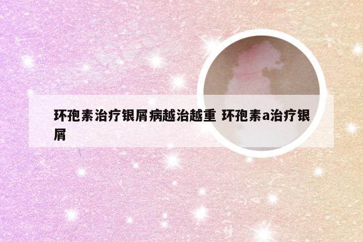 环孢素治疗银屑病越治越重 环孢素a治疗银屑