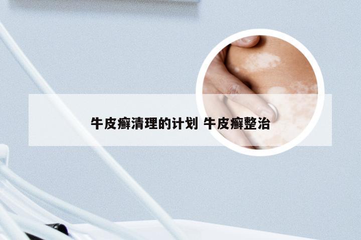 牛皮癣清理的计划 牛皮癣整治