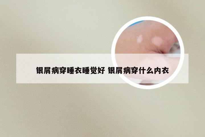银屑病穿睡衣睡觉好 银屑病穿什么内衣