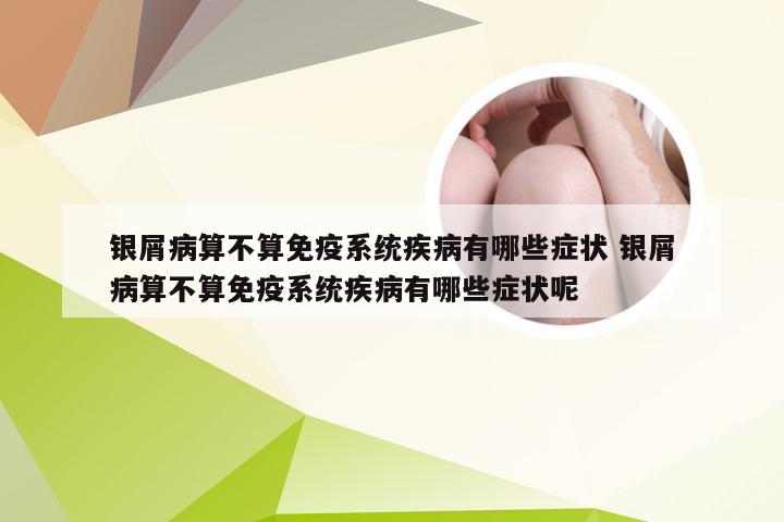 银屑病算不算免疫系统疾病有哪些症状 银屑病算不算免疫系统疾病有哪些症状呢