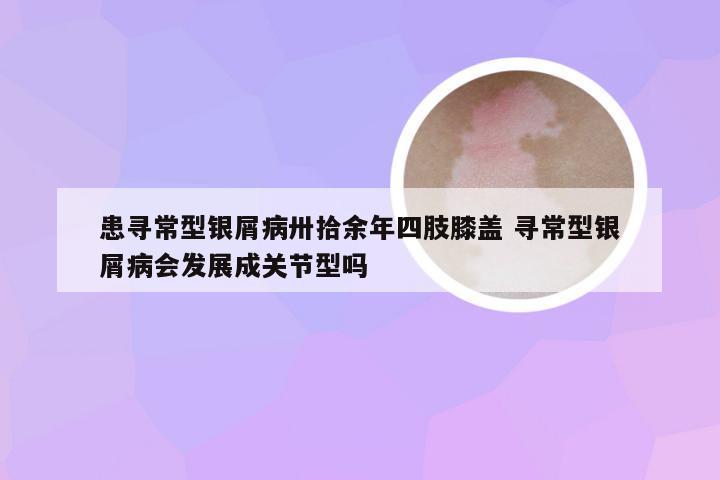 患寻常型银屑病卅拾余年四肢膝盖 寻常型银屑病会发展成关节型吗