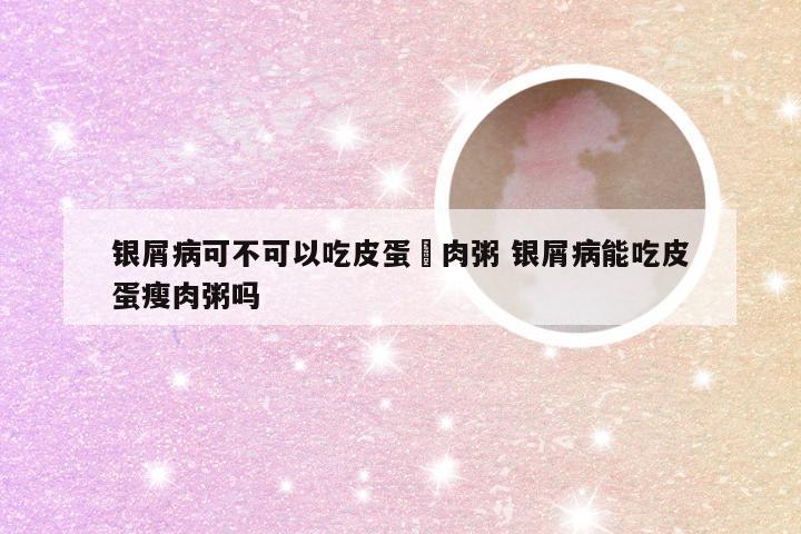 银屑病可不可以吃皮蛋廋肉粥 银屑病能吃皮蛋瘦肉粥吗