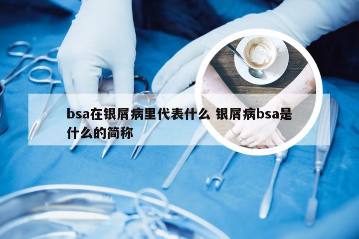 bsa在银屑病里代表什么 银屑病bsa是什么的简称