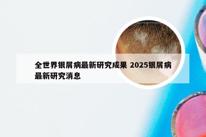 全世界银屑病最新研究成果 2025银屑病最新研究消息