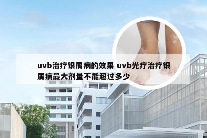uvb治疗银屑病的效果 uvb光疗治疗银屑病最大剂量不能超过多少