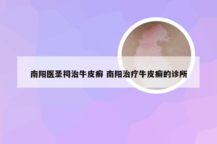 南阳医圣祠治牛皮癣 南阳治疗牛皮癣的诊所