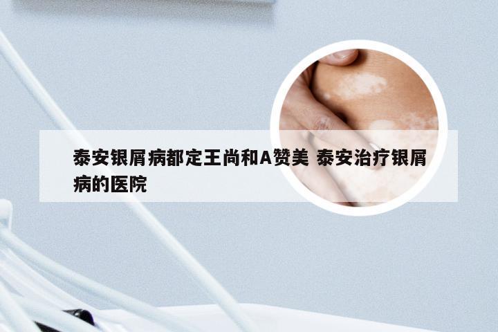 泰安银屑病都定王尚和A赞美 泰安治疗银屑病的医院