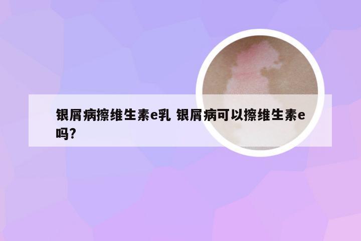 银屑病擦维生素e乳 银屑病可以擦维生素e吗?