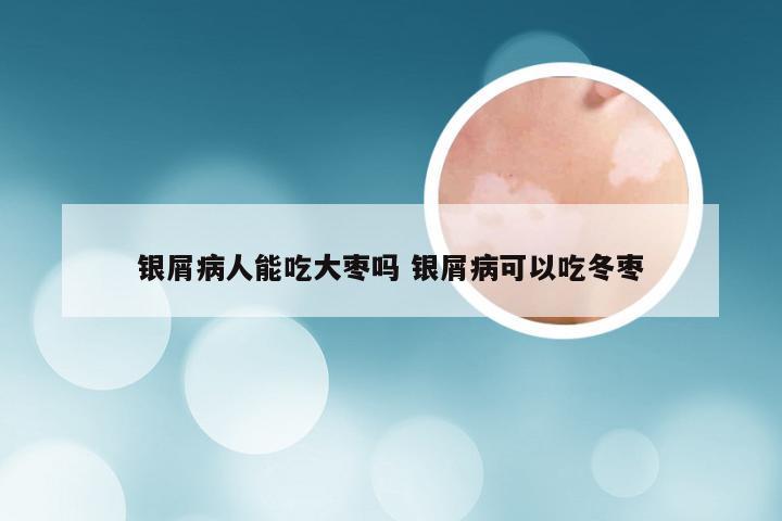 银屑病人能吃大枣吗 银屑病可以吃冬枣