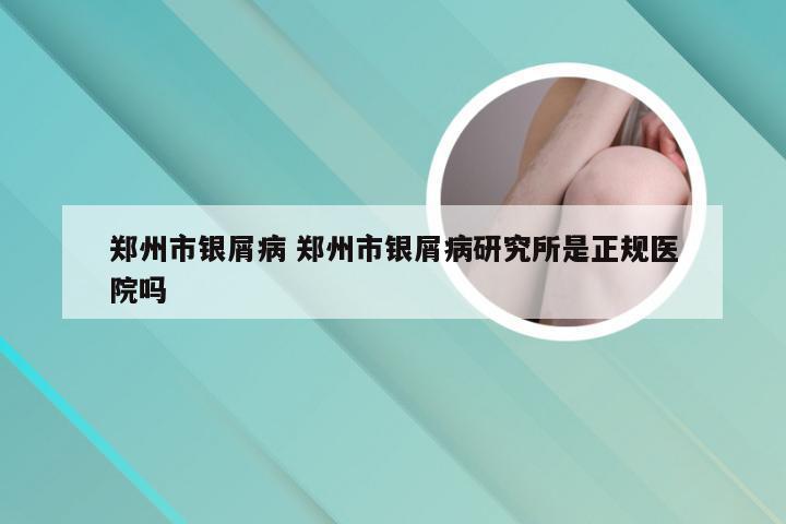 郑州市银屑病 郑州市银屑病研究所是正规医院吗