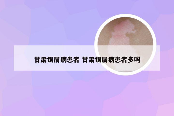 甘肃银屑病患者 甘肃银屑病患者多吗