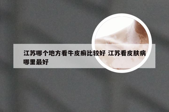 江苏哪个地方看牛皮癣比较好 江苏看皮肤病哪里最好
