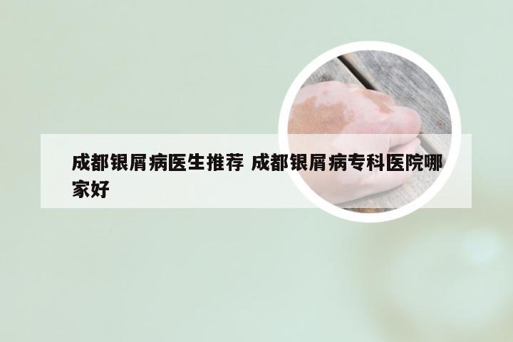 成都银屑病医生推荐 成都银屑病专科医院哪家好
