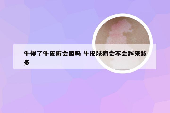 牛得了牛皮癣会困吗 牛皮肤癣会不会越来越多