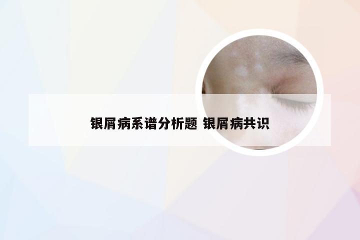 银屑病系谱分析题 银屑病共识