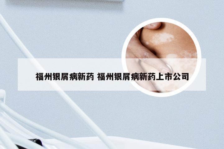 福州银屑病新药 福州银屑病新药上市公司