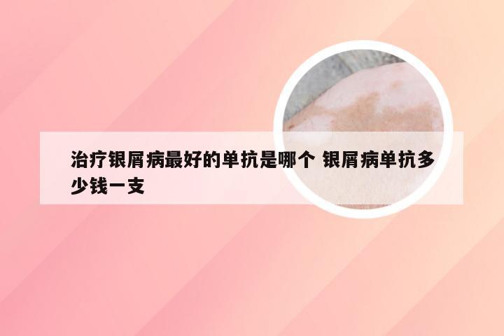 治疗银屑病最好的单抗是哪个 银屑病单抗多少钱一支