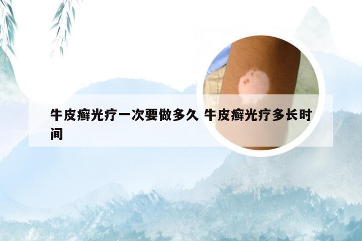 牛皮癣光疗一次要做多久 牛皮癣光疗多长时间