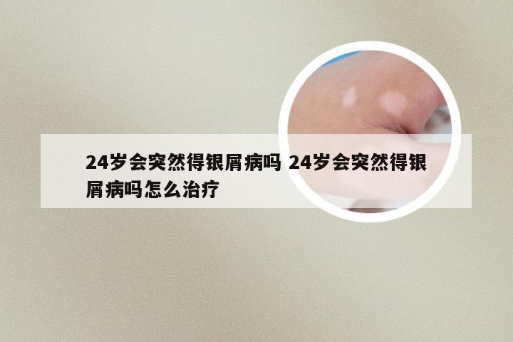 24岁会突然得银屑病吗 24岁会突然得银屑病吗怎么治疗