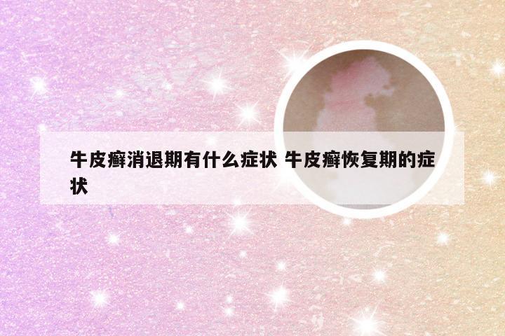 牛皮癣消退期有什么症状 牛皮癣恢复期的症状