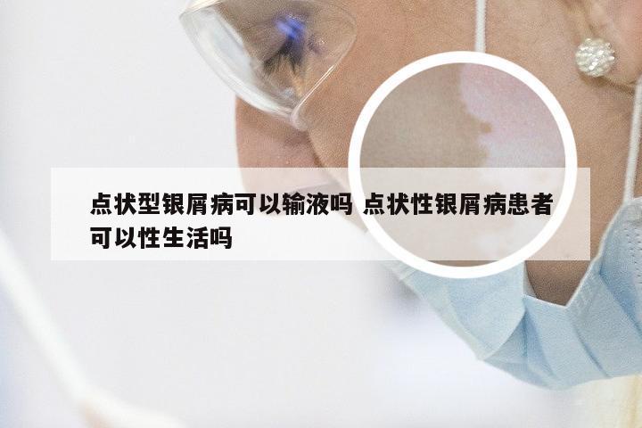 点状型银屑病可以输液吗 点状性银屑病患者可以性生活吗